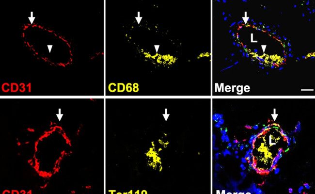 Descubrimiento de una nueva célula podría revolucionar el tratamiento de la diabetes y la cicatrización