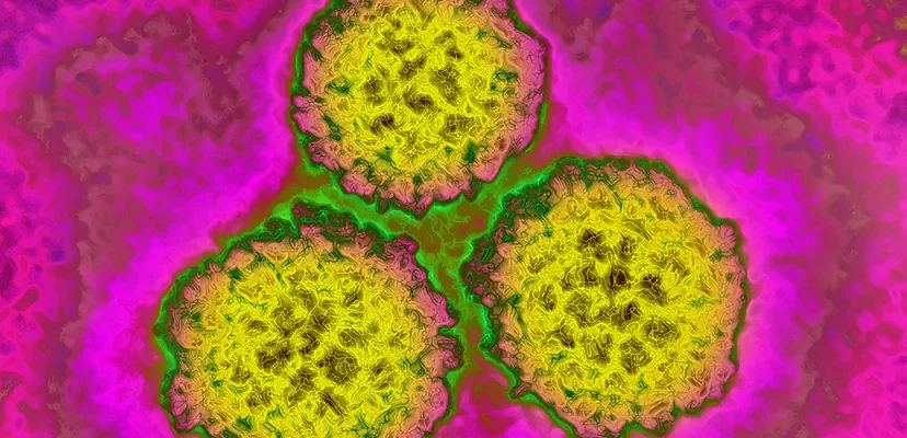 El alarmante aumento del cáncer: ¿qué nos dicen los últimos datos globales?