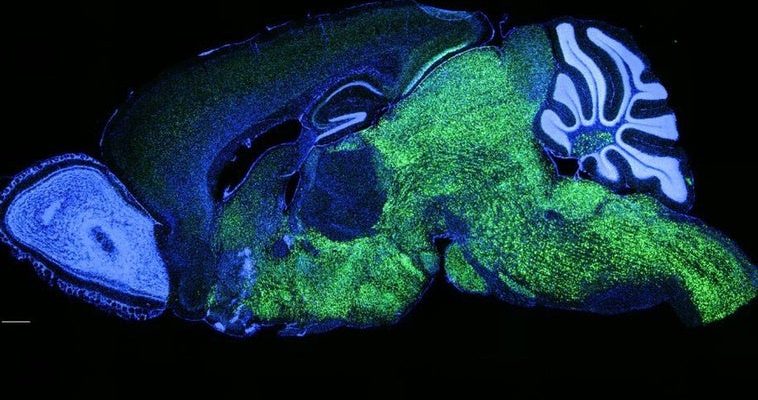 La sorprendente conexión entre la genética y la aparición del lenguaje humano