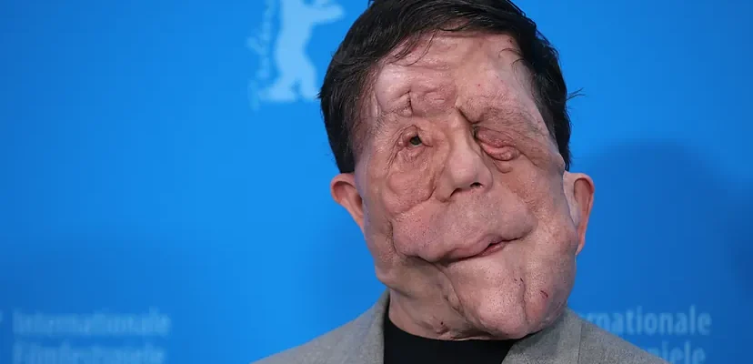 Adam Pearson: un nuevo rostro de la diversidad en el cine actual