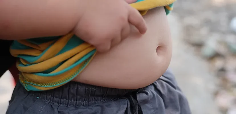 El impacto devastador de la obesidad: proyecciones alarmantes y el futuro incierto de la salud pública